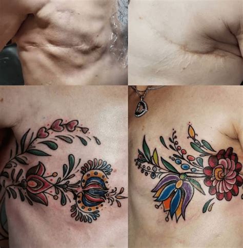 Mastectomy Scar Tattoo Inspiration